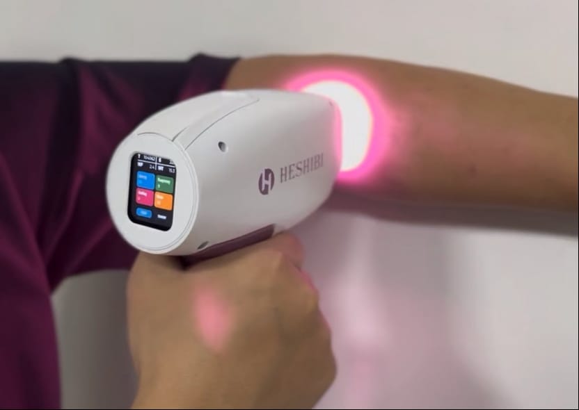 5 Essential Insights About ODM Diode Laser Hair Removal